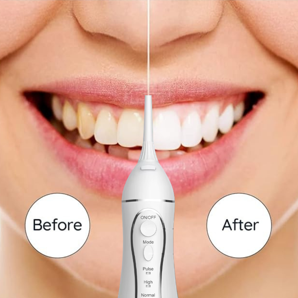 ™Mornwell– סילון מים דנטלי